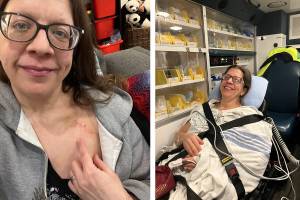 Left: Chilliwack Progress journalist Jenna Hauck, 47, points to her new pacemaker scar 12 days after the device was implanted in her. At right, she is seen riding in an ambulance on Dec. 4, 2025 on her way to Surrey Memorial Hospital for an MRI.